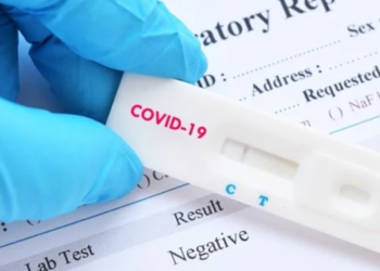 An Important Aspect of COVID-19 Research and Testing Is Reverse Transcriptase
