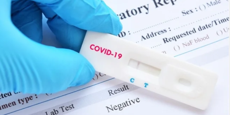 An Important Aspect of COVID-19 Research and Testing Is Reverse Transcriptase